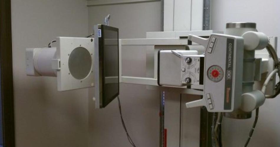 एक सय ५० रुपैयाँमा वडाबाटै एक्स–रे सेवा