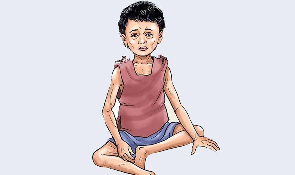 मधेसका १६ प्रतिशत बालबालिकामा कुपोषण